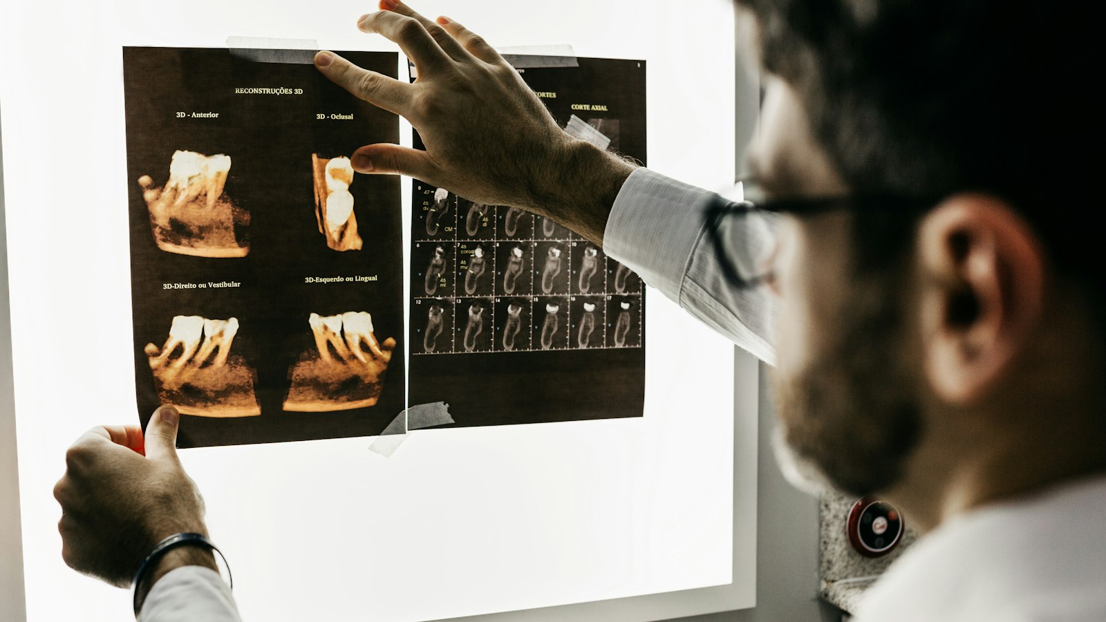 Dentist reviewing 3D tooth and implant imaging on a light box